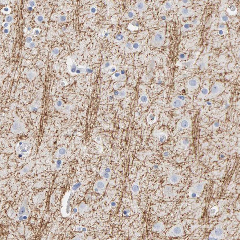 MOG Antibody Immunohistochemistry: MOG Antibody [MOG Antibody]