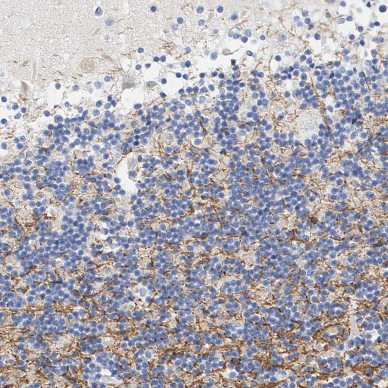 MOG Antibody Immunohistochemistry: MOG Antibody [MOG Antibody]