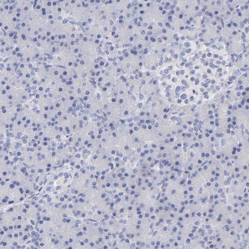 MOG Antibody Immunohistochemistry: MOG Antibody [MOG Antibody]