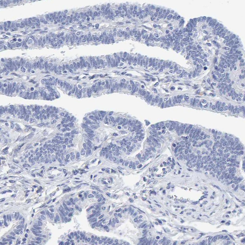 MOG Antibody Immunohistochemistry: MOG Antibody [MOG Antibody]