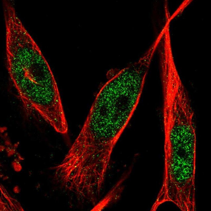 6 Phosphofructo 2 Kinase Antibody - BSA Free Immunocytochemistry/ Immunofluorescence: 6 Phosphofructo 2 Kinase Antibody [NBP1-87478]