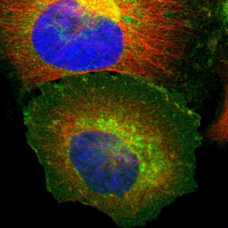 beta 2-Microglobulin Antibody - BSA Free Immunocytochemistry/ Immunofluorescence: beta 2-Microglobulin Antibody [NBP1-87482]