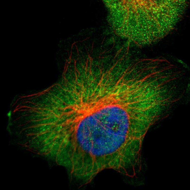 Aldolase A Antibody - BSA Free Immunocytochemistry/ Immunofluorescence: Aldolase A Antibody [NBP1-87488]