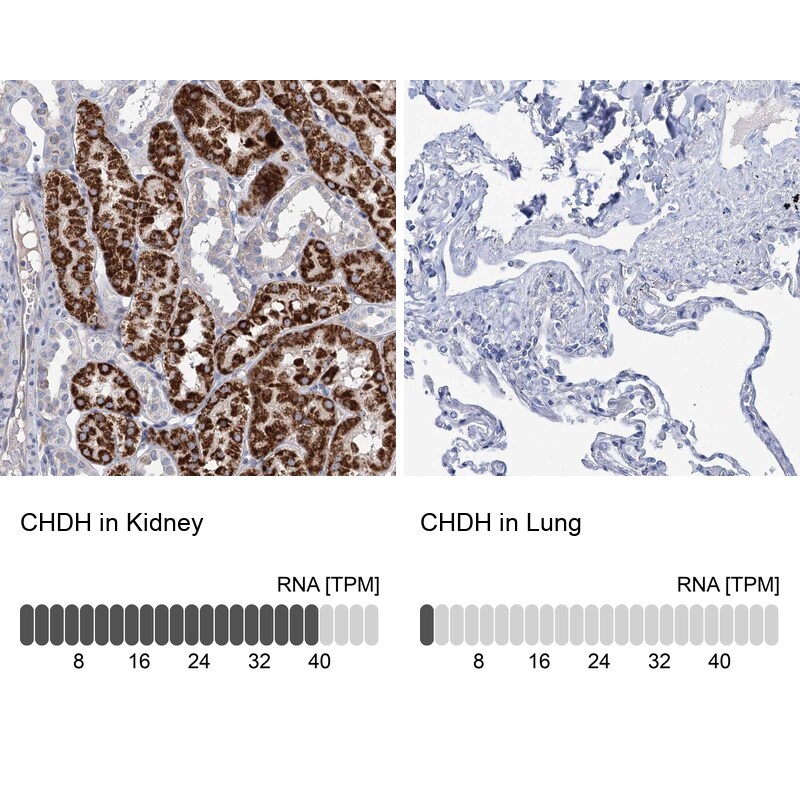 Choline dehydrogenase Antibody - BSA Free Immunohistochemistry-Paraffin: Choline dehydrogenase Antibody [NBP1-87508]