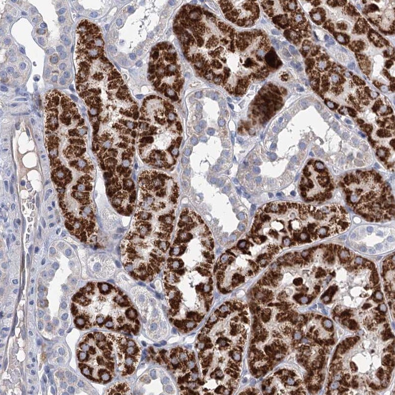 Choline dehydrogenase Antibody - BSA Free Immunohistochemistry-Paraffin: Choline dehydrogenase Antibody [NBP1-87508]