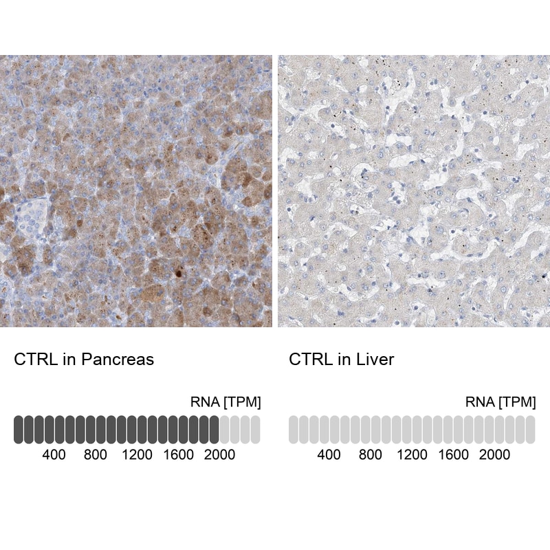 Chymotrypsin-like protease Antibody - BSA Free Immunohistochemistry-Paraffin: Chymotrypsin-like protease Antibody [NBP1-87520]