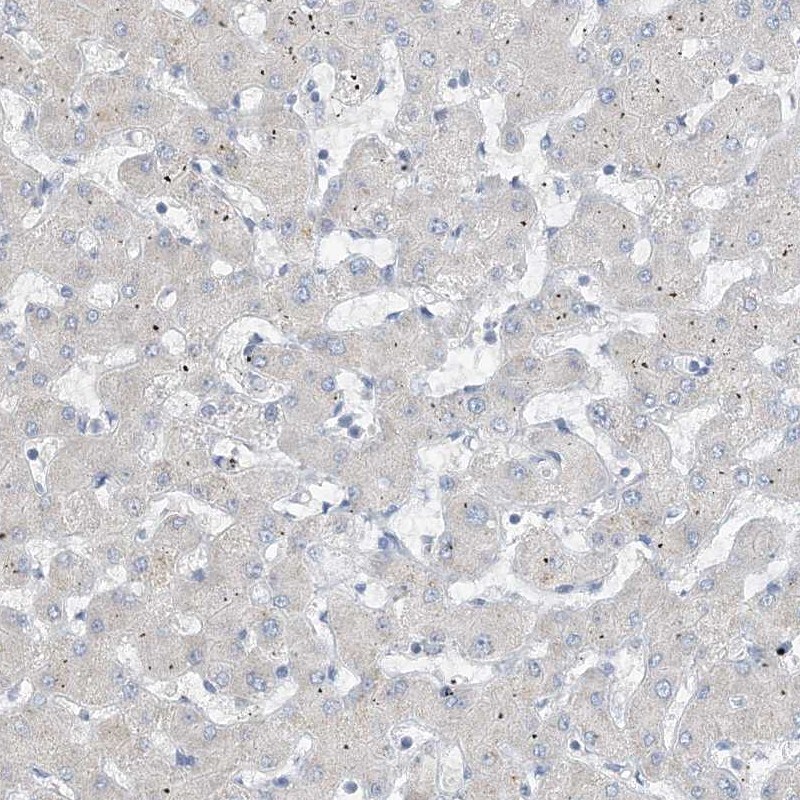 Chymotrypsin-like protease Antibody - BSA Free Immunohistochemistry-Paraffin: Chymotrypsin-like protease Antibody [NBP1-87520]