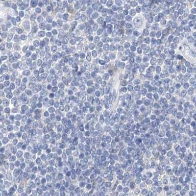 Chymotrypsin-like protease Antibody - BSA Free Immunohistochemistry-Paraffin: Chymotrypsin-like protease Antibody [NBP1-87520]
