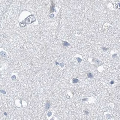 Chymotrypsin-like protease Antibody - BSA Free Immunohistochemistry-Paraffin: Chymotrypsin-like protease Antibody [NBP1-87520]