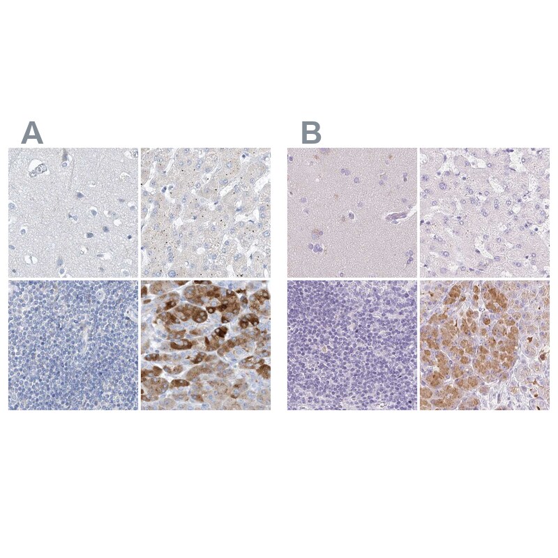 Chymotrypsin-like protease Antibody - BSA Free Immunohistochemistry-Paraffin: Chymotrypsin-like protease Antibody [NBP1-87520]