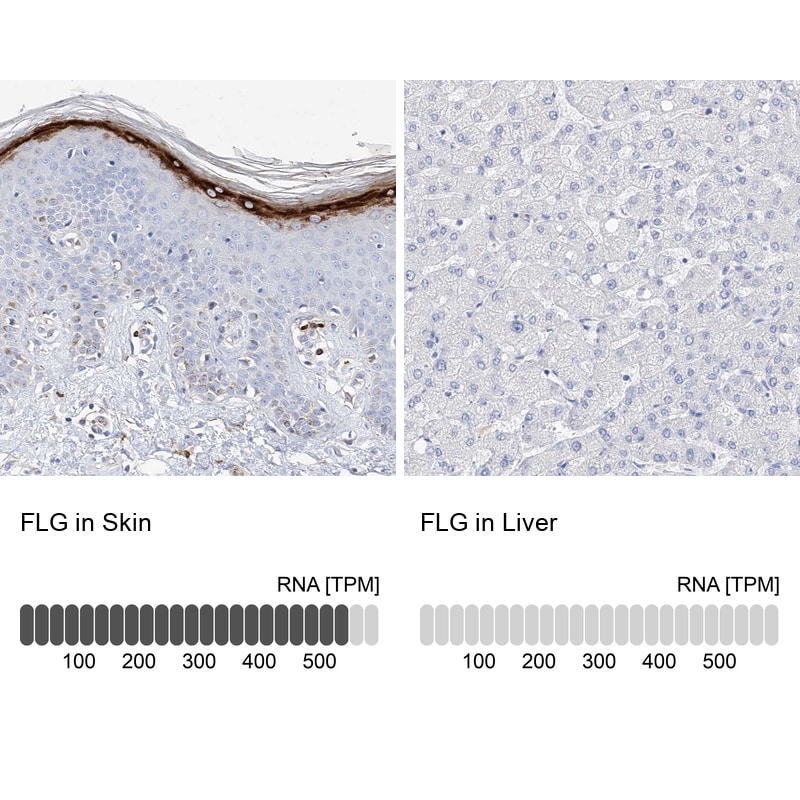 Filaggrin Antibody - BSA Free Immunohistochemistry-Paraffin: Filaggrin Antibody [NBP1-87528]
