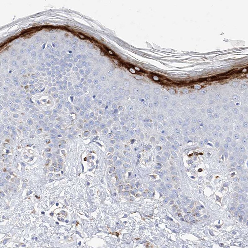 Filaggrin Antibody - BSA Free Immunohistochemistry-Paraffin: Filaggrin Antibody [NBP1-87528]