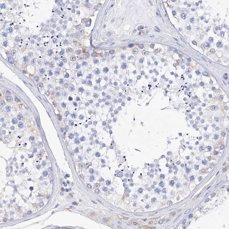 Filaggrin Antibody - BSA Free Immunohistochemistry-Paraffin: Filaggrin Antibody [NBP1-87528]