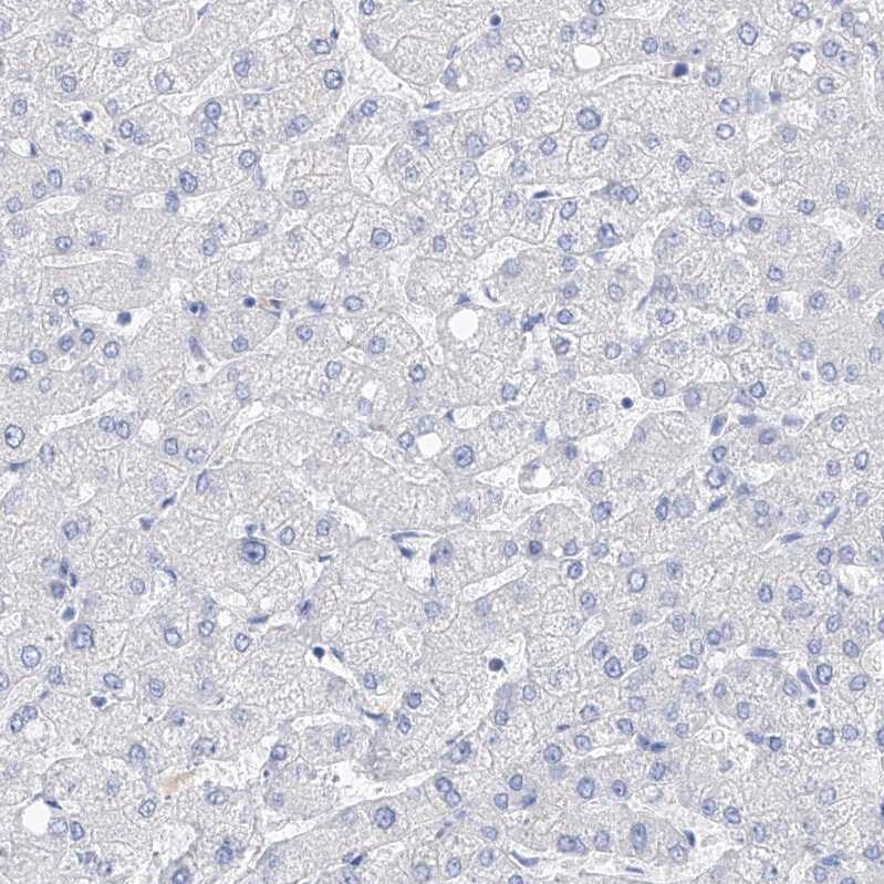 Filaggrin Antibody - BSA Free Immunohistochemistry-Paraffin: Filaggrin Antibody [NBP1-87528]