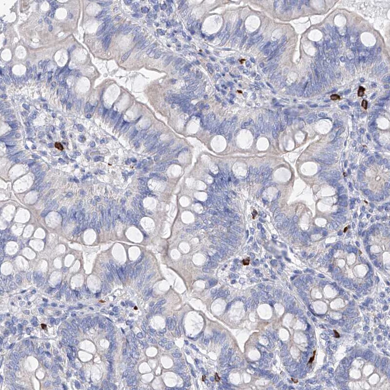 Filaggrin Antibody - BSA Free Immunohistochemistry-Paraffin: Filaggrin Antibody [NBP1-87528]