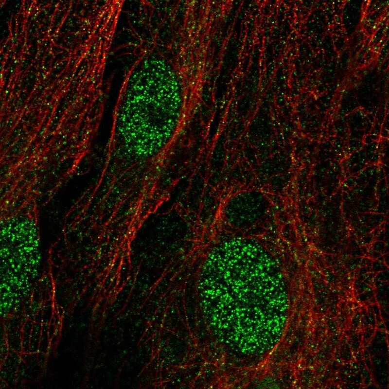 TRMT9B Antibody - BSA Free Immunocytochemistry/ Immunofluorescence: TRMT9B Antibody [NBP1-87541]