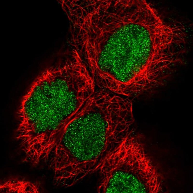 Pygopus-2 Antibody - BSA Free Immunocytochemistry/ Immunofluorescence: Pygopus-2 Antibody [NBP1-87548]