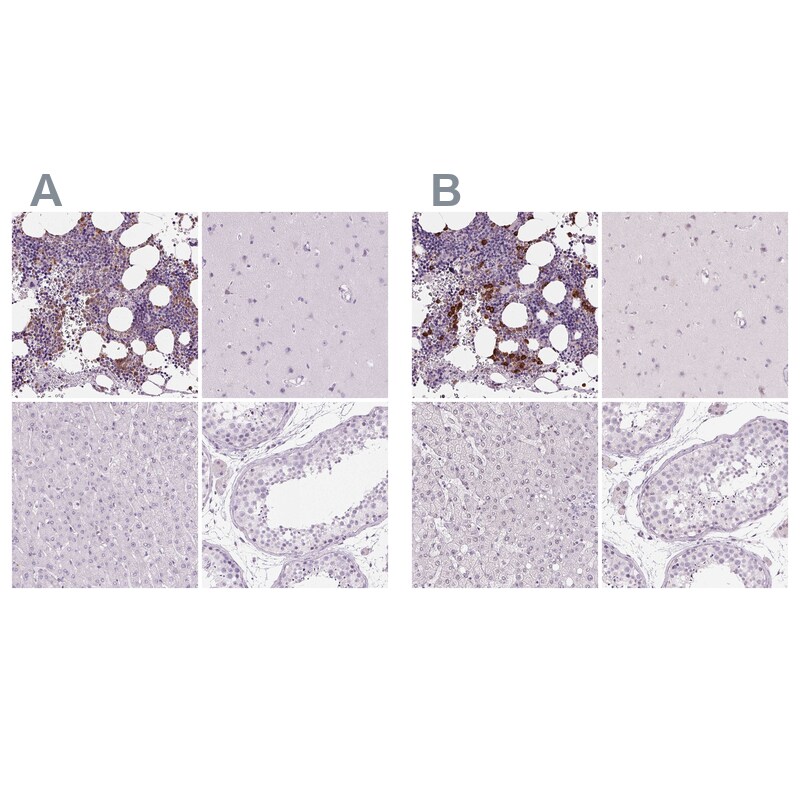 Myeloperoxidase/MPO Antibody Immunohistochemistry-Paraffin: Myeloperoxidase/MPO Antibody Antibody [NBP1-87556]