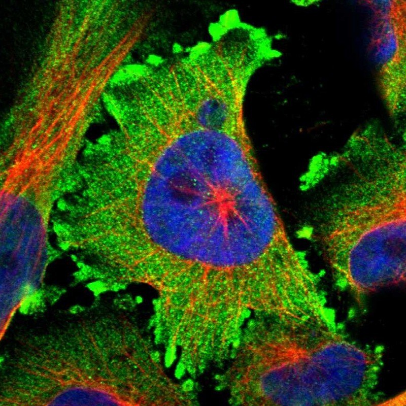 Amphiphysin/AMPH Antibody - BSA Free Immunocytochemistry/ Immunofluorescence: Amphiphysin/AMPH Antibody [NBP1-87561]