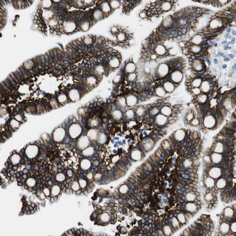 Cadherin-8 Antibody - BSA Free Immunohistochemistry: Cadherin-8 Antibody - BSA Free [NBP1-87571]