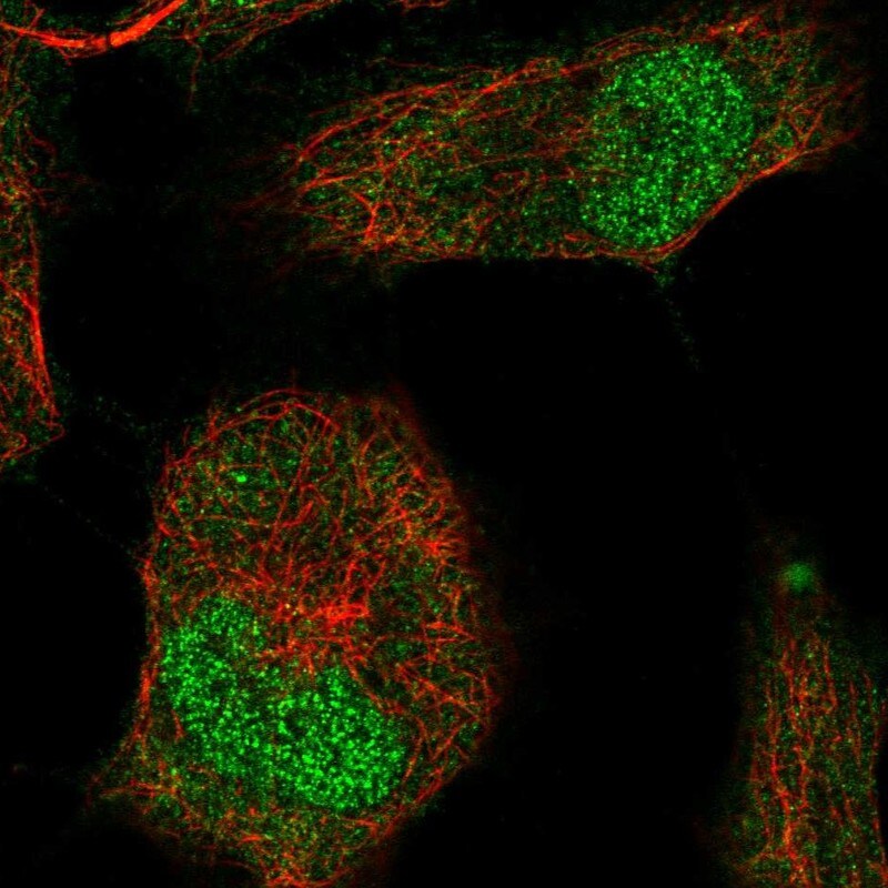 Brachyury Antibody - BSA Free Immunocytochemistry/ Immunofluorescence: Brachyury Antibody - BSA Free [NBP1-87598]