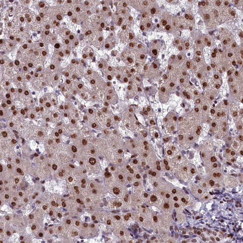 Caspase 5 Antibody - BSA Free Immunohistochemistry: Caspase 5 Antibody - BSA Free [NBP1-87682]