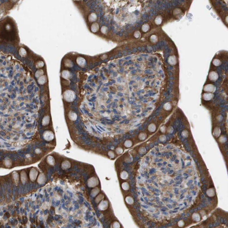 Caspase-10/FLICE2 Antibody - BSA Free Immunohistochemistry-Paraffin: Caspase-10/FLICE2 Antibody [NBP1-87685]