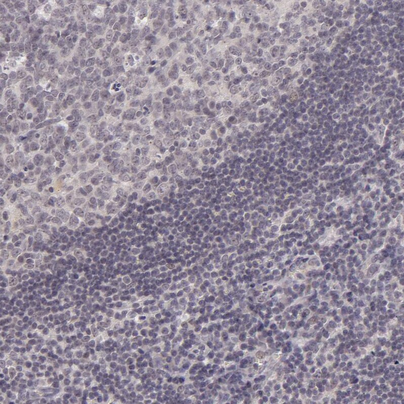 SAP102 Antibody - BSA Free Immunohistochemistry-Paraffin: SAP102 Antibody [NBP1-87691]