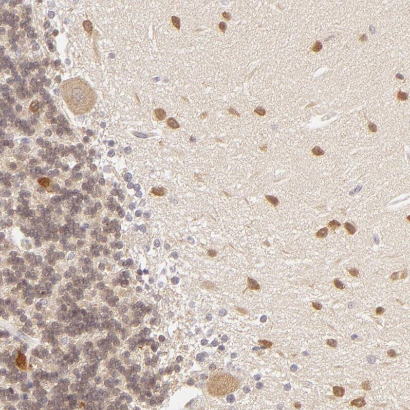 SAP102 Antibody - BSA Free Immunohistochemistry-Paraffin: SAP102 Antibody [NBP1-87691]