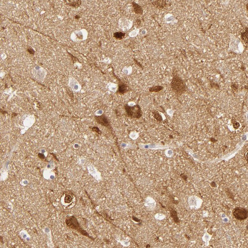 SAP102 Antibody - BSA Free Immunohistochemistry-Paraffin: SAP102 Antibody [NBP1-87691]