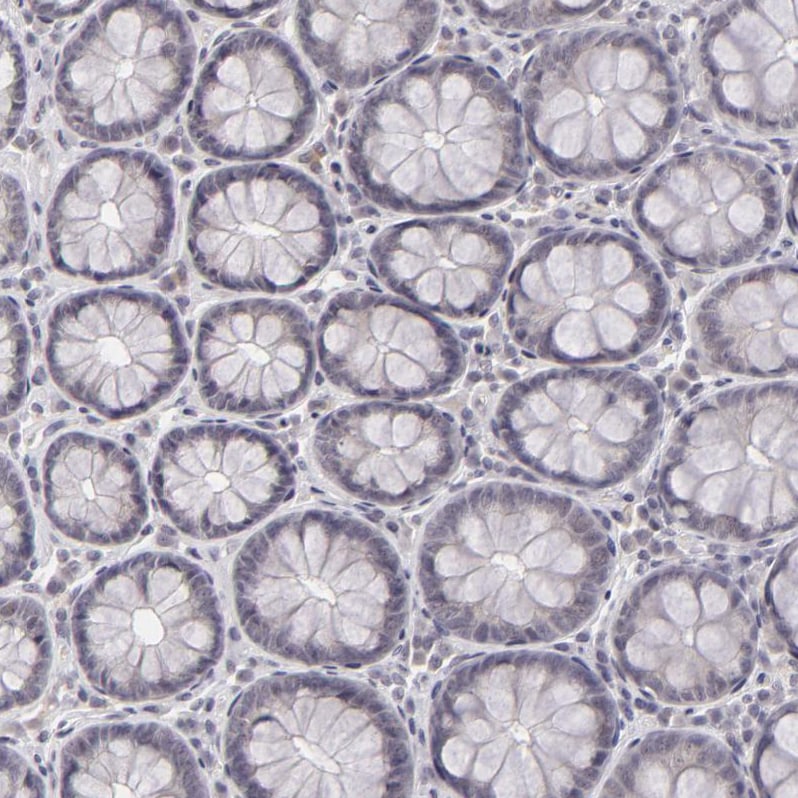 SAP102 Antibody - BSA Free Immunohistochemistry-Paraffin: SAP102 Antibody [NBP1-87691]