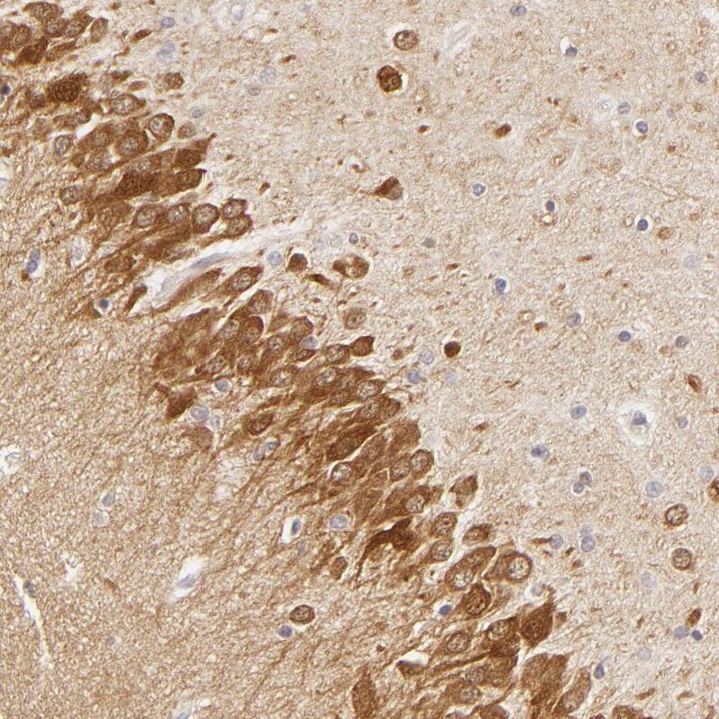 SAP102 Antibody - BSA Free Immunohistochemistry-Paraffin: SAP102 Antibody [NBP1-87691]