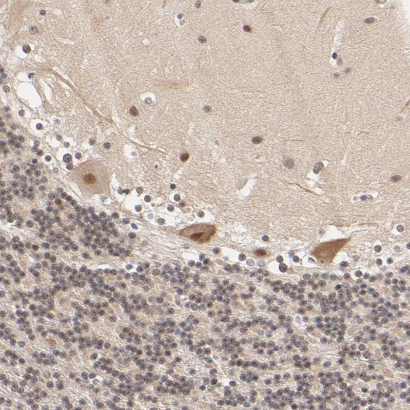 KAT3B/p300 Antibody - BSA Free Immunohistochemistry: KAT3B/p300 Antibody - BSA Free [NBP1-87693]