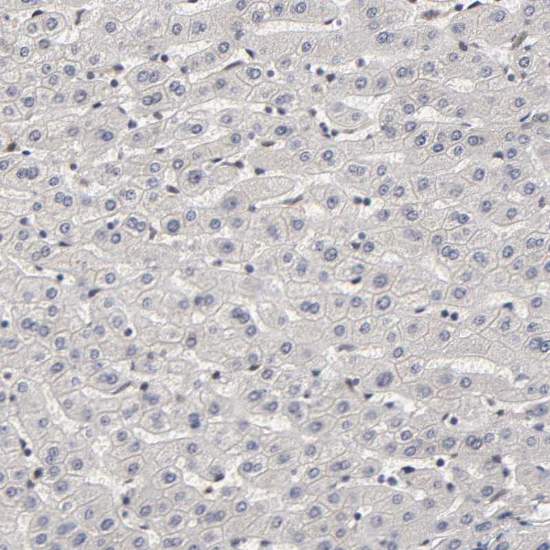 KAT3B/p300 Antibody - BSA Free Immunohistochemistry: KAT3B/p300 Antibody - BSA Free [NBP1-87693]