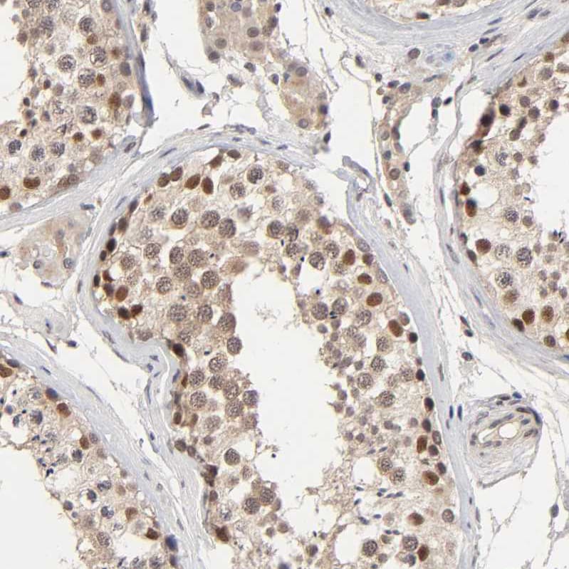 KAT3B/p300 Antibody - BSA Free Immunohistochemistry: KAT3B/p300 Antibody - BSA Free [NBP1-87693]