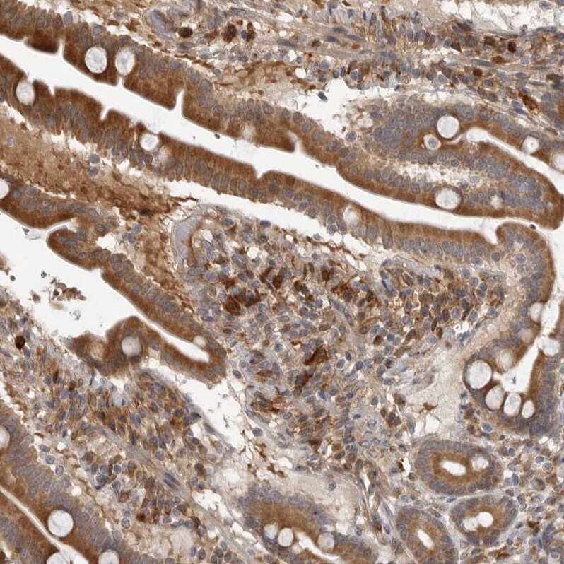 Indoleamine 2,3-dioxygenase/IDO Antibody - BSA Free Immunohistochemistry-Paraffin: Indoleamine 2,3-dioxygenase/IDO Antibody [NBP1-87701]