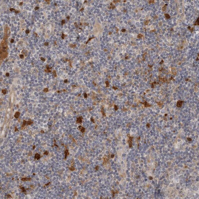 Indoleamine 2,3-dioxygenase/IDO Antibody - BSA Free Immunohistochemistry-Paraffin: Indoleamine 2,3-dioxygenase/IDO Antibody [NBP1-87701]