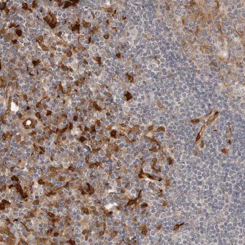 Indoleamine 2,3-dioxygenase/IDO Antibody - BSA Free Immunohistochemistry-Paraffin: Indoleamine 2,3-dioxygenase/IDO Antibody [NBP1-87701]