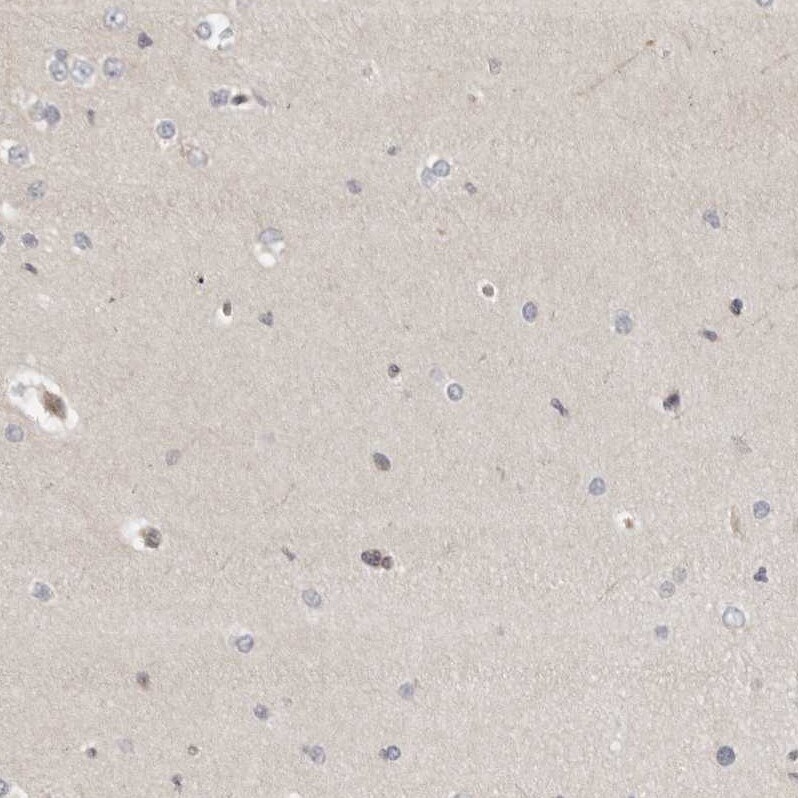 Indoleamine 2,3-dioxygenase/IDO Antibody - BSA Free Immunohistochemistry-Paraffin: Indoleamine 2,3-dioxygenase/IDO Antibody [NBP1-87701]