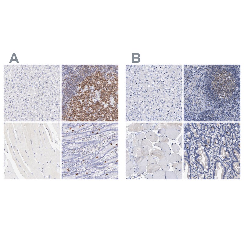 LRMP/Jaw1 Antibody Immunohistochemistry-Paraffin: LRMP/Jaw1 Antibody Antibody [NBP1-87724]