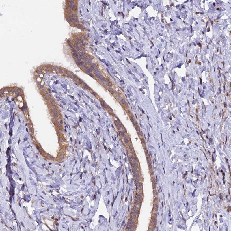 MAN2C1 Antibody - BSA Free Immunohistochemistry-Paraffin: MAN2C1 Antibody [NBP1-87729]
