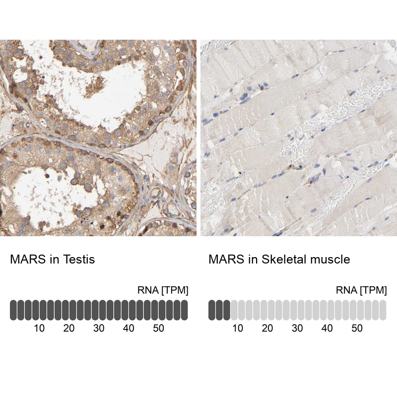 Methionyl tRNA synthetase Antibody - BSA Free Immunohistochemistry-Paraffin: Methionyl tRNA synthetase Antibody [NBP1-87730]