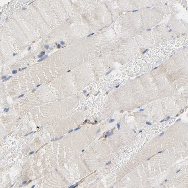 Methionyl tRNA synthetase Antibody - BSA Free Immunohistochemistry-Paraffin: Methionyl tRNA synthetase Antibody [NBP1-87730]