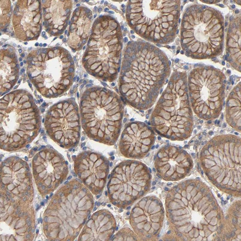 Methionyl tRNA synthetase Antibody - BSA Free Immunohistochemistry-Paraffin: Methionyl tRNA synthetase Antibody [NBP1-87730]