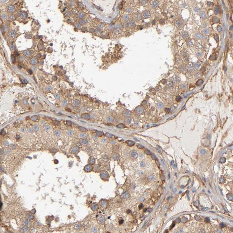 Methionyl tRNA synthetase Antibody - BSA Free Immunohistochemistry-Paraffin: Methionyl tRNA synthetase Antibody [NBP1-87730]