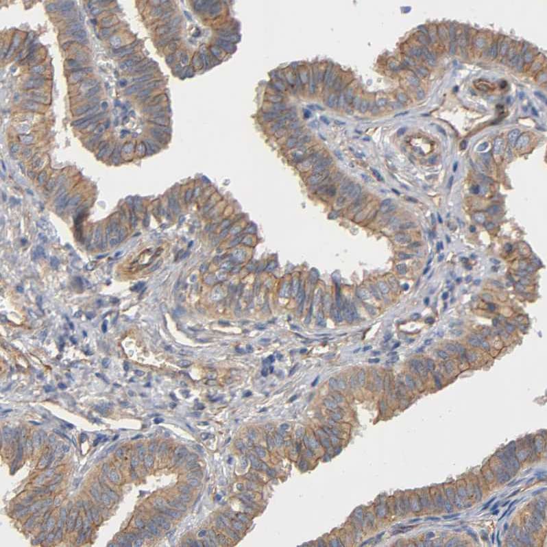 Methionyl tRNA synthetase Antibody - BSA Free Immunohistochemistry-Paraffin: Methionyl tRNA synthetase Antibody [NBP1-87730]