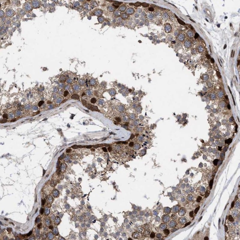 MDMX Antibody - BSA Free Immunohistochemistry: MDMX Antibody - BSA Free [NBP1-87733]