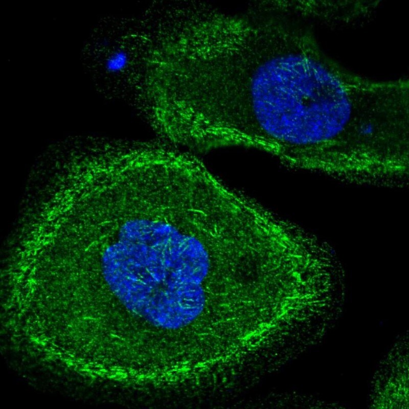 MLK2 Antibody - BSA Free Immunocytochemistry/ Immunofluorescence: MLK2 Antibody [NBP1-87737]