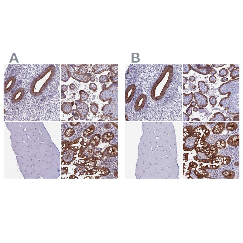 Myosin VB Antibody - BSA Free Immunohistochemistry-Paraffin: Myosin VB Antibody [NBP1-87746]