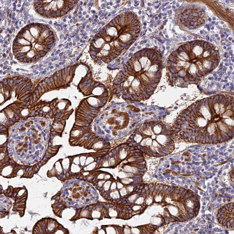 Myosin VB Antibody - BSA Free Immunohistochemistry-Paraffin: Myosin VB Antibody [NBP1-87746]